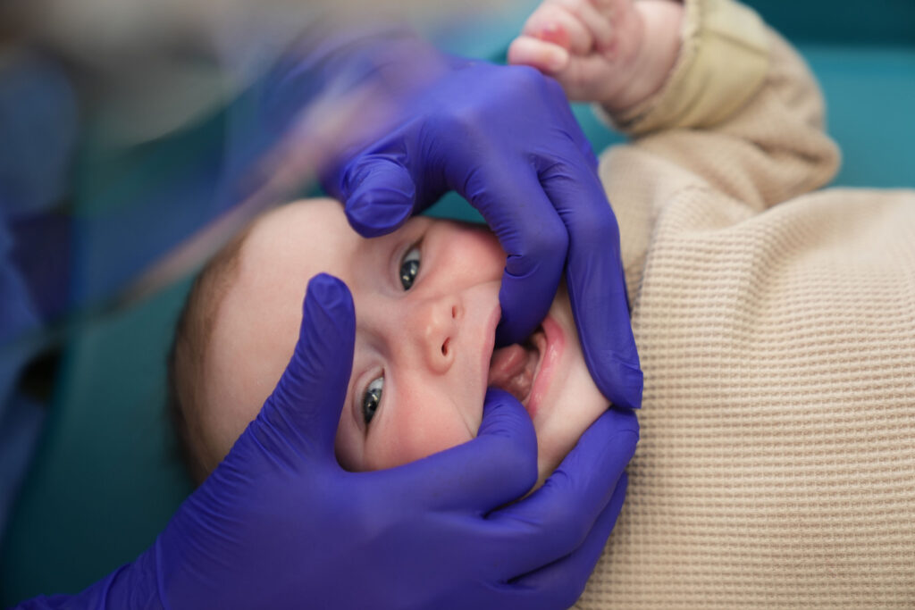baby mouth open