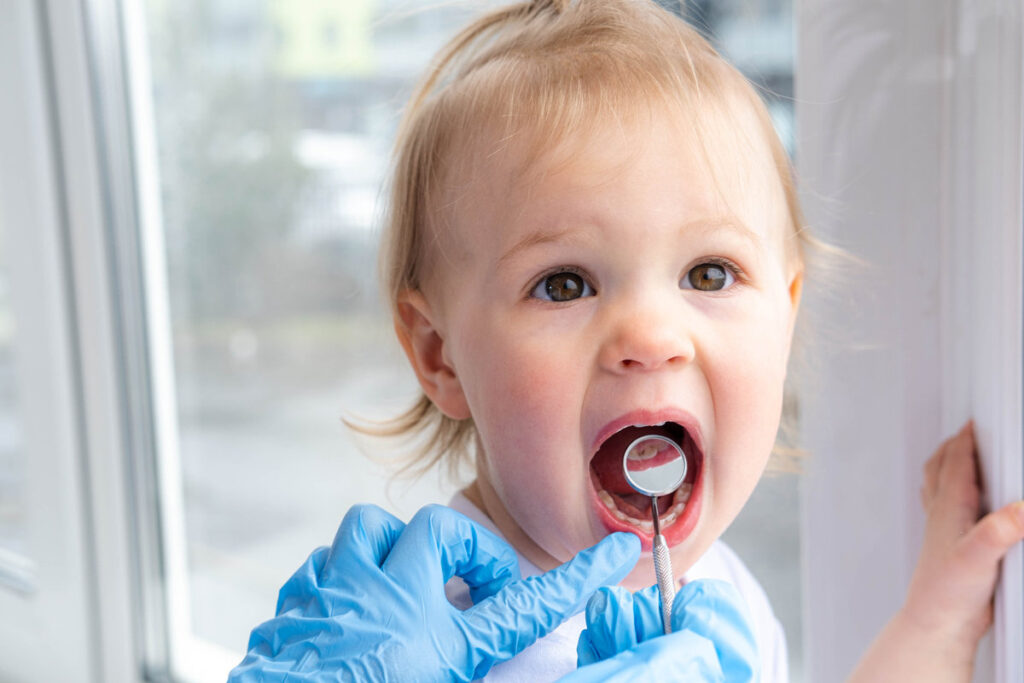 Closeup open mouth child and mirror in dentists hands in blue gloves checkup examine treating teeth to child, health care, children dental hygiene