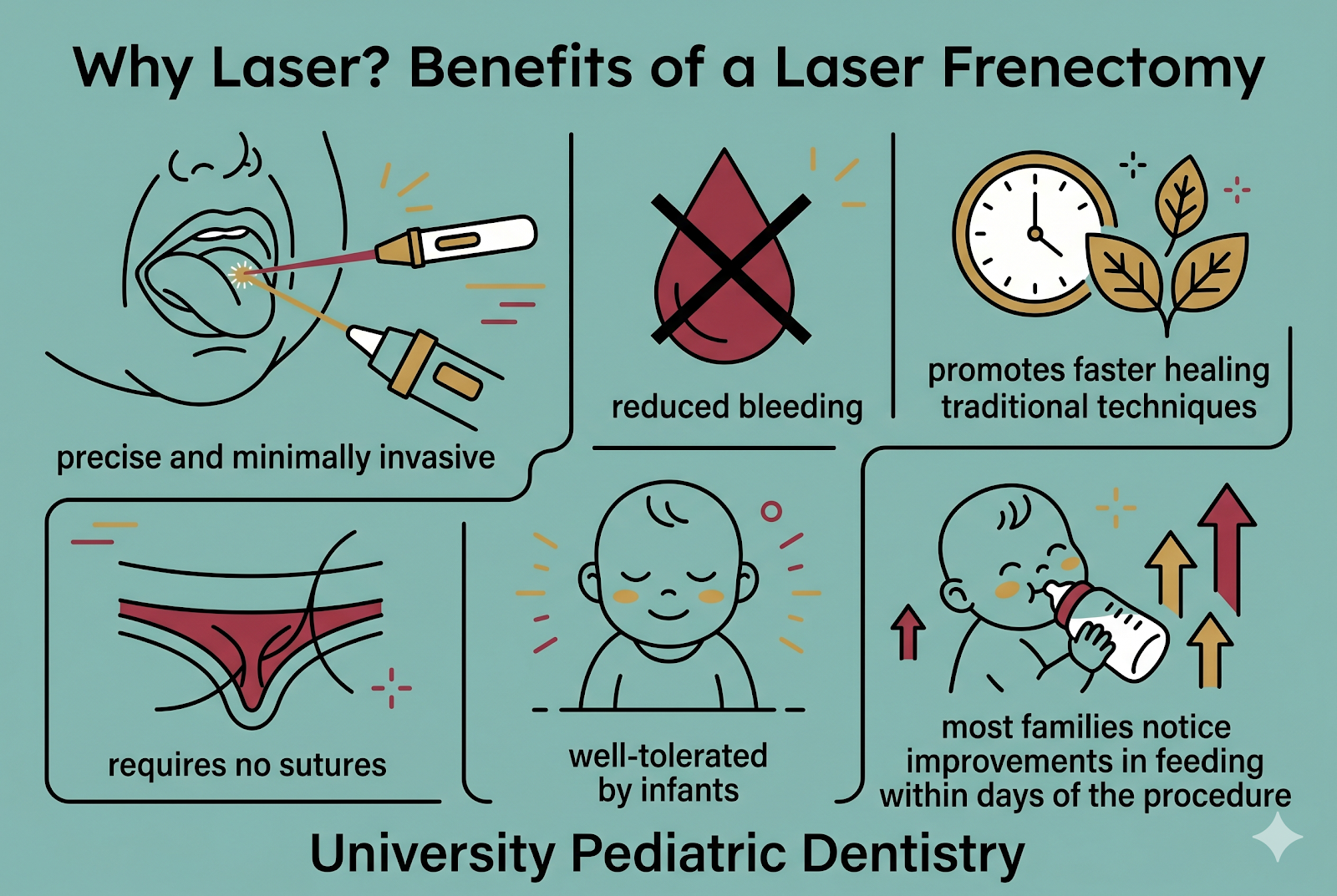 Infographic showing signs of tongue-tie and lip-tie in infants and frenectomy process